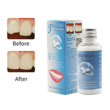 Ŝargi bildon en Galerio-spektilon, HRRSDental 30ML Temporary Tooth Repair Kit Filling Teeth Gaps Moldable False Teeth Solid Glue Denture Adhesive
