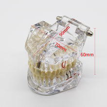 Ŝargi bildon en Galerio-spektilon, HRRSDental Implant Dental Disease Teeth Model With Restoration Bridge Tooth For Medical Science Dental Disease Teaching Study Tool
