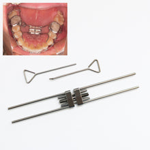 Ŝargi bildon en Galerio-spektilon, HRRSDental Dental Orthodontics Neoksidebla Ekspansio Ŝraŭbo Rapida Palata Expandilo Kadro Dentoj Arko Drato Materialo
