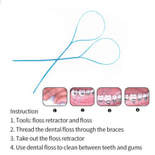 Ŝargi bildon en Galerio-spektilon, HRRSDental 35Pcs/Set Dental Floss Threaders Needle Tooth Brackets Wire Holders Between Orthodontic Bridges Traction Braces Blue Color HRRSDental
