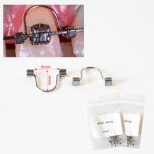 Cargar imagen en el visor de la galería, HRRSDental  Door Type Torque Spring Orthodontic Single Anterior 1Pack 10pcs HRRSDental
